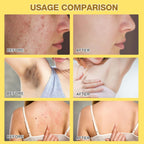 Bee Venom Skin Treatment Cream